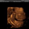 View the image: IMAGES_54